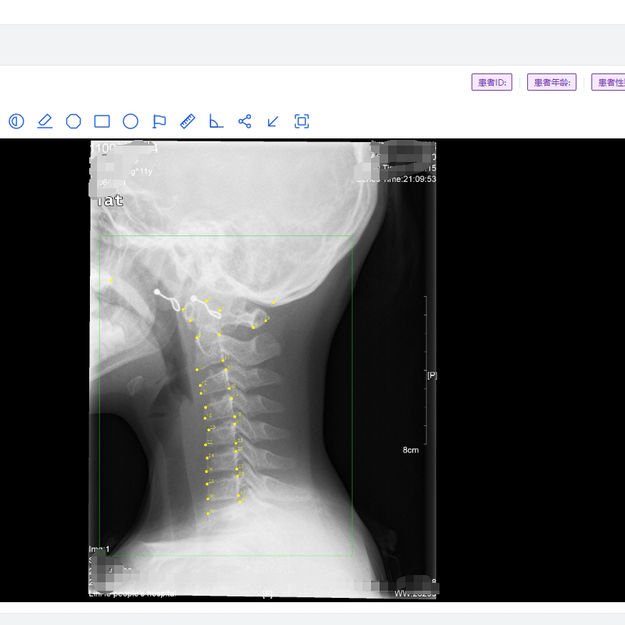 AI软件定制开发